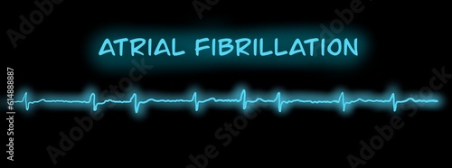 ECG example of atrial fibrillation with black background