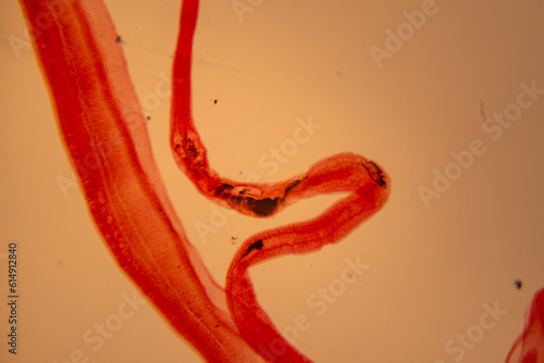 photo of human parasite worms under the microscope