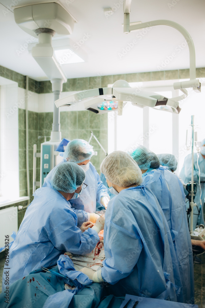 a group of doctors during cesarean births a group of doctors during cesarean births
