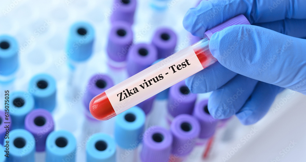 Obraz premium Doctor holding a test blood sample tube with Zika virus test on the background of medical test tubes with analyzes.
