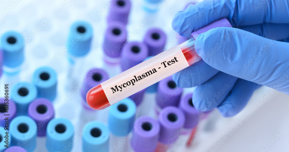 Naklejka premium Doctor holding a test blood sample tube with Mycoplasma test on the background of medical test tubes with analyzes.