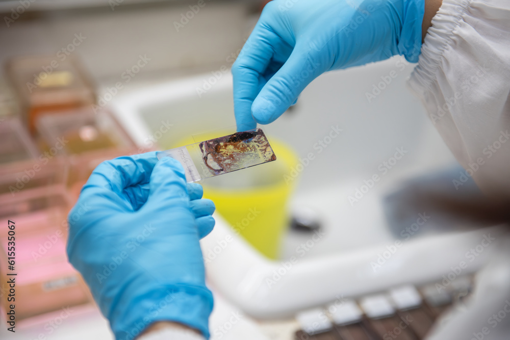 Medical scientists preparing cytology slides for pathologists to diagnose in hospital.
