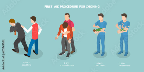 3D Isometric Flat Vector Conceptual Illustration of First Aid Procedure For Choking, Heimlich Maneuver photo