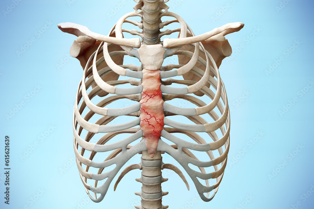 Injured sternum fracture skeleton Stock Illustration | Adobe Stock