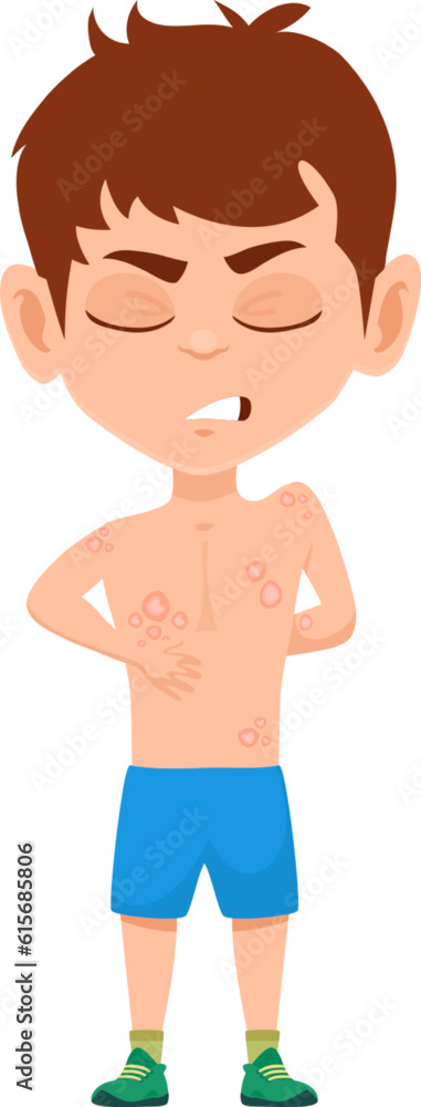 Child with ringworm tinea disease symptoms. Isolated vector sick boy with rash caused by fungal infection of skin. Dermatophytosis illness with red, itchy, scaly, circular rash on body Child with ringworm tinea disease symptoms. Isolated vector sick boy with rash caused by fungal infection of skin. Dermatophytosis illness with red, itchy, scaly, circular rash on body