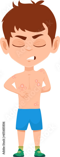 Child with ringworm tinea disease symptoms. Isolated vector sick boy with rash caused by fungal infection of skin. Dermatophytosis illness with red, itchy, scaly, circular rash on body