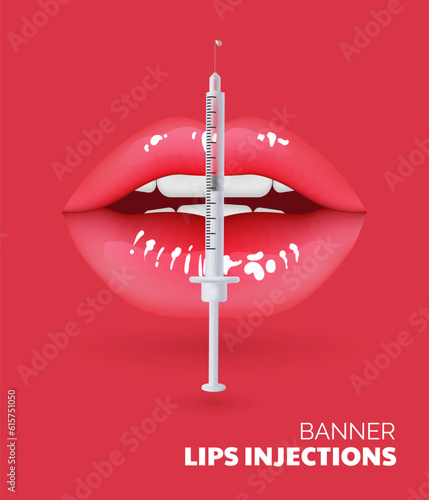 3D illustration of realistic lips undergoing a cosmetic procedure for aging care. Results of lip injections and wrinkle reduction, the correction and contouring of lips using fillers injection. 