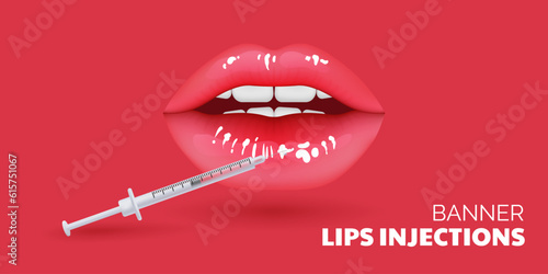3D illustration of realistic lips undergoing a cosmetic procedure for aging care. Beauty clinic concept showcases the correction and contouring of lips using fillers injections. Ideal for health care