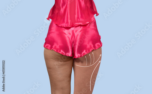 Woman's thighs and buttocks...
