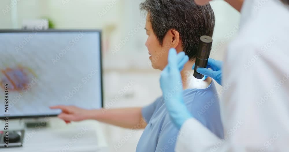 doctor exam mole with microscope doctor exam mole with microscope