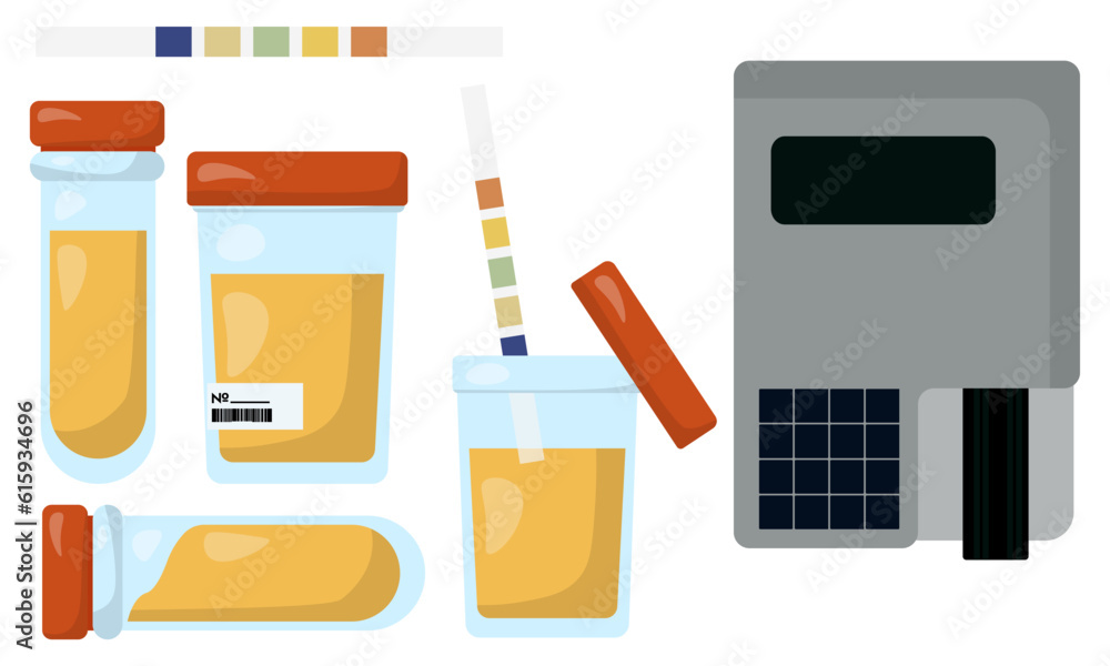 urine analyzer and test tubes with urine, containers and equipment for