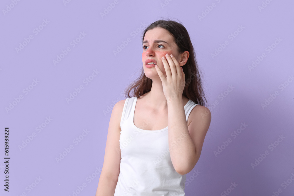 Allergic young woman with sunburned face on lilac background Allergic young woman with sunburned face on lilac background
