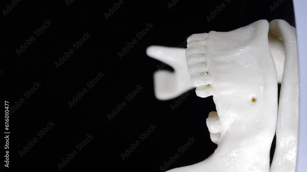 Rotating jaw model of human teeth with implants and placeholder pins