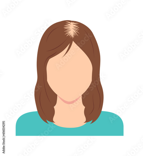 Female Androgenetic Alopecia vector illustration