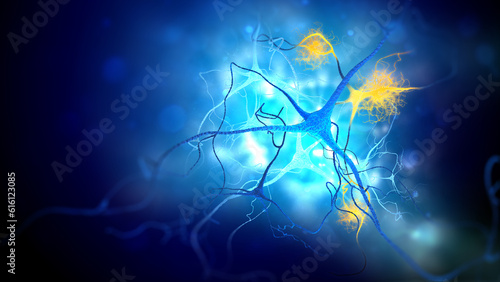 Neurons damaged by Alzheimer's disease (3d illustration) photo