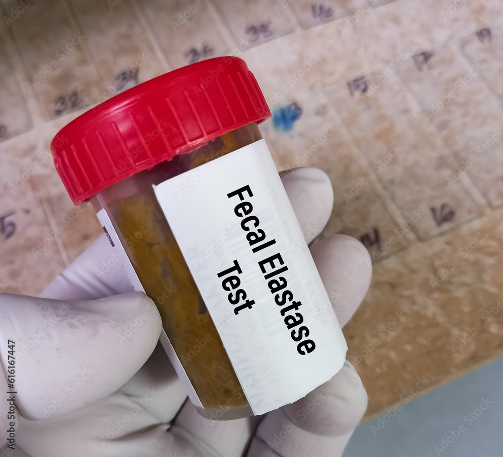 Stool Elastase Dynacare at Tyra Colon blog