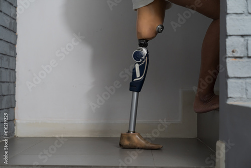 Female with prosthetic leg walking up the stair at home. Woman handicapper with prosthetic leg. Woman with leg prosthesis equipment photo