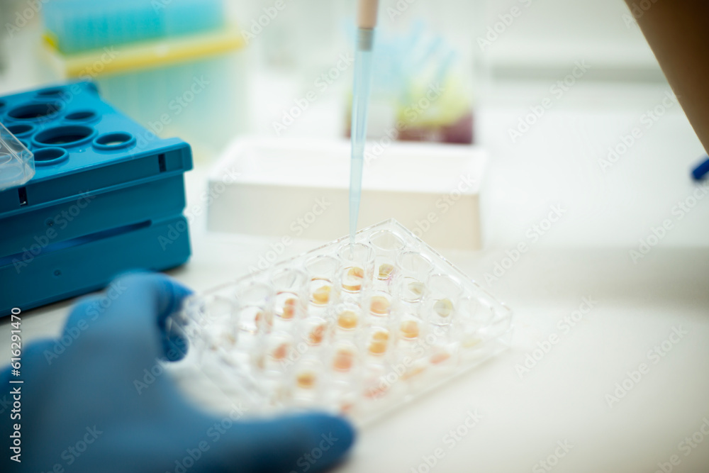 Cell culture at the cell culture genetic bioprocess medicine and medical labrotory Cell culture at the cell culture genetic bioprocess medicine and medical labrotory