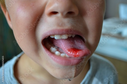 Εκτύπωση καμβά Close-up of lips, tongue, protrusion of blood
