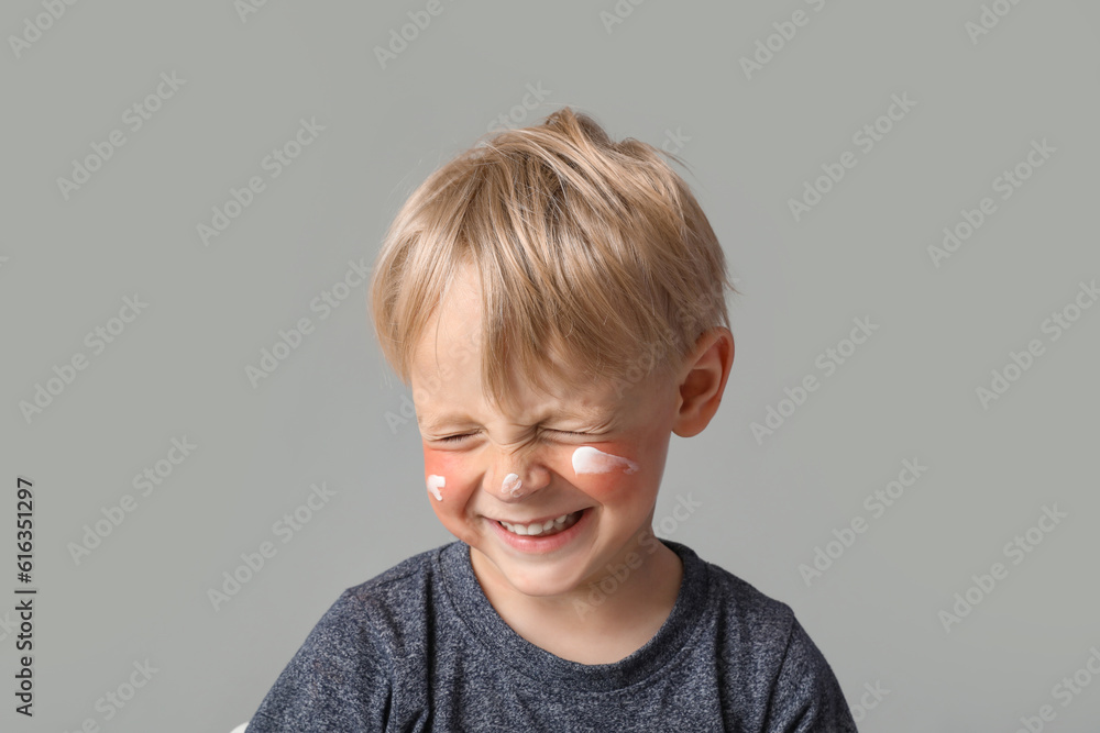 Allergic little boy with sunburned face and cream on grey background, closeup Allergic little boy with sunburned face and cream on grey background, closeup