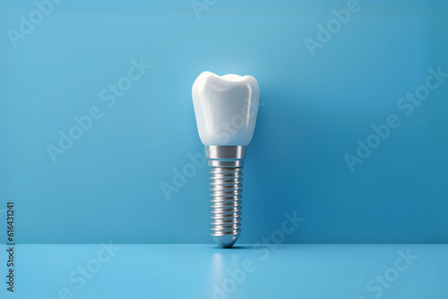 3d dental implant on a blue background. Dentist. Teeth. Human health.