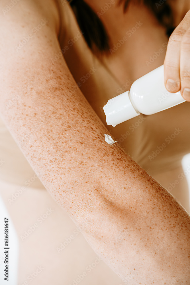 Φωτογραφία Woman with freckles applying cream on her body, skin protection from the sun, moisturizing the skin