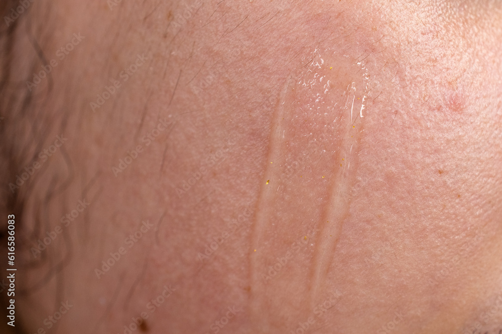 Fototapeta premium Close-up of a woman with clear moisturizer on her face 