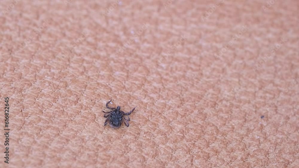 parasite tick, mite from order Ixodidae, blood-sucking parasites crawls on skin, Acariformes, carrier of dangerous disease encephalitis, surveillance systems, tick-borne disease prevention strategies parasite tick, mite from order Ixodidae, blood-sucking parasites crawls on skin, Acariformes, carrier of dangerous disease encephalitis, surveillance systems, tick-borne disease prevention strategies