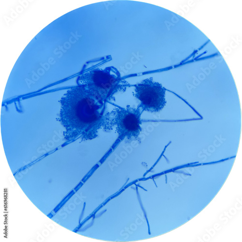 Aspergillus spp. with hyaline septate hyphae.  photo