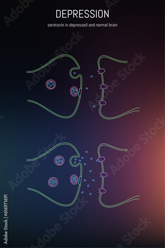 Neuroscience of depression. Difference of brain chemistry in depressed brain and normal brain. Lack of serotonin in depressed brain. 