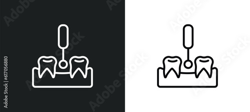 interproximal line icon in white and black colors. interproximal flat vector icon from interproximal collection for web, mobile apps and ui.