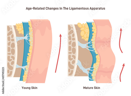 Aging process and face skin ligaments loosening. Close-up skin