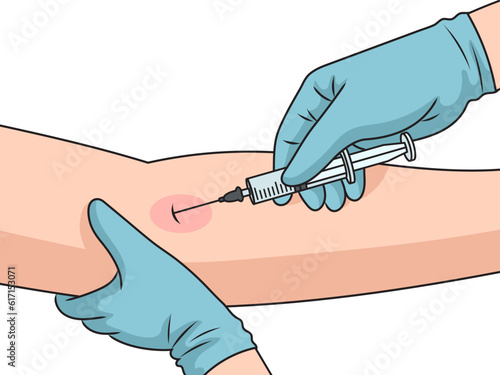 Injection of medicine with syringe in hand intravenous injection schematic vector illustration. Medical science educational illustration