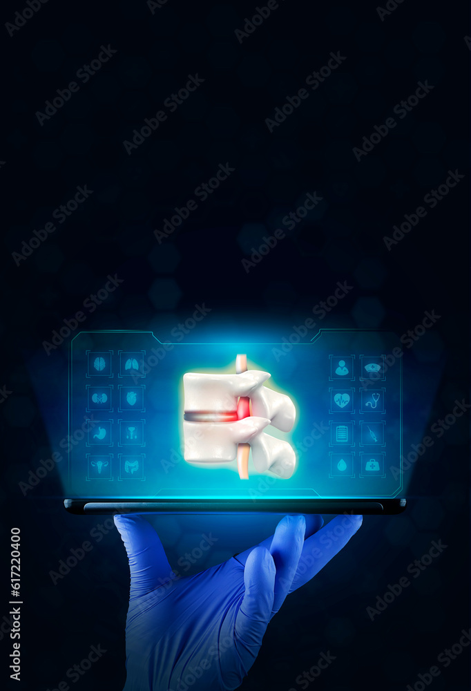 Spinal herniation, herniated disc. back pain, spine. disc pain, The