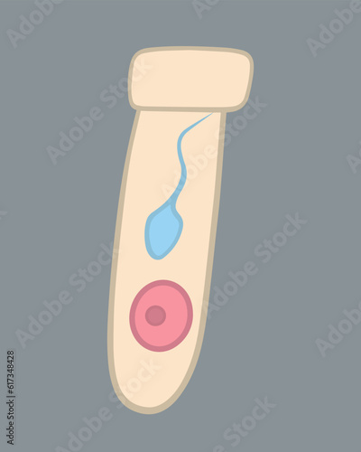 Artificial insemination vector isolated illustration. In vitro fertilization. Egg donation. Sperm reporting. Freezing sperm and eggs.
