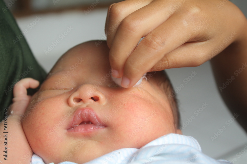 The baby's eyes are being cleaned using cotton wool The baby's eyes are being cleaned using cotton wool