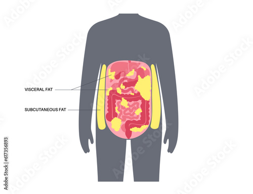 Visceral fat diagram