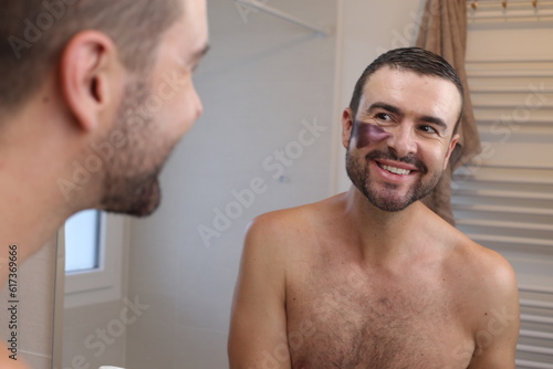 Man with an interesting birthmark  photo