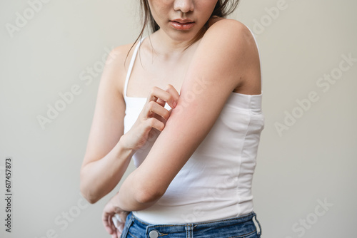Print op canvas Dermatology, asian young woman reaction from atopic, insect bites on her arm, hand in scratching itchy red spot or rash of skin