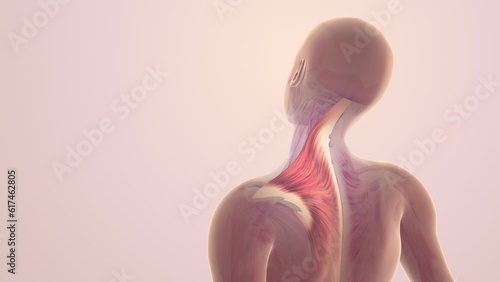 Shoulder and trapezius muscle pain photo
