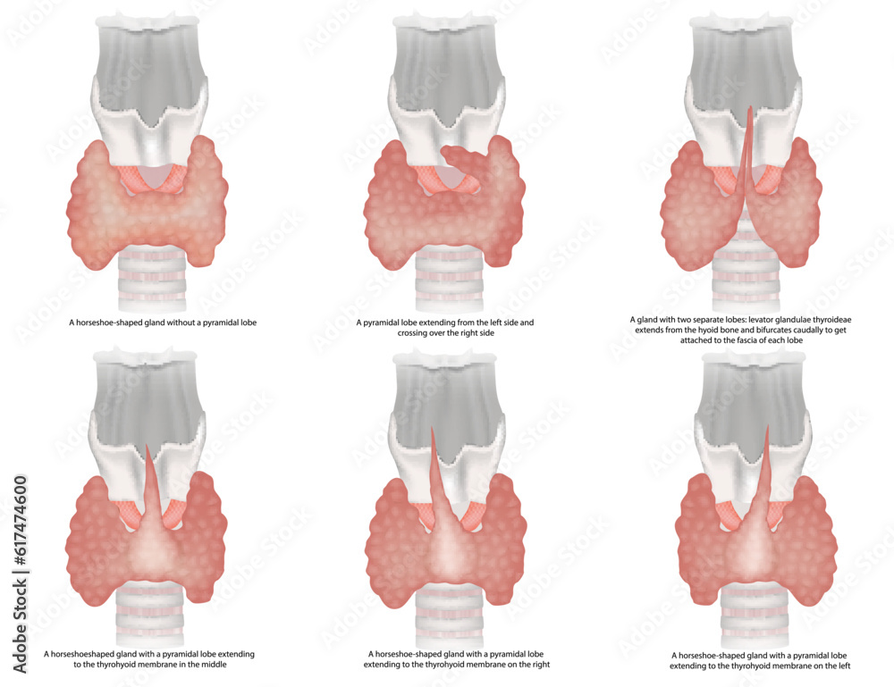 Illustration of the classification of the thyroid gland shapes. The