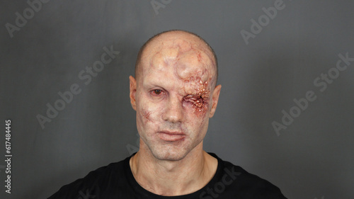 Balding Mutant Man With bad skin 