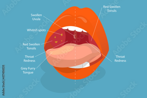 3D Isometric Flat Vector Conceptual Illustration of Parts Of Human Mouth, Educational Diagram