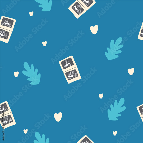 Realistic Detailed Pregnancy Seamless Pattern Background Positive Results. Ultrasound photo of a baby pregnancy Vector illustration its a boy