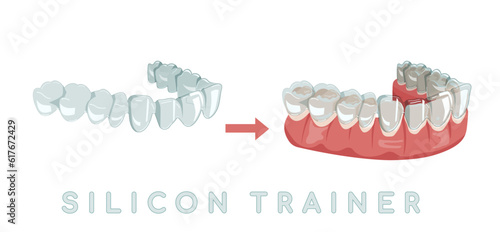 Invisible braces aligner, retainer. Medical drawing in cartoon style.