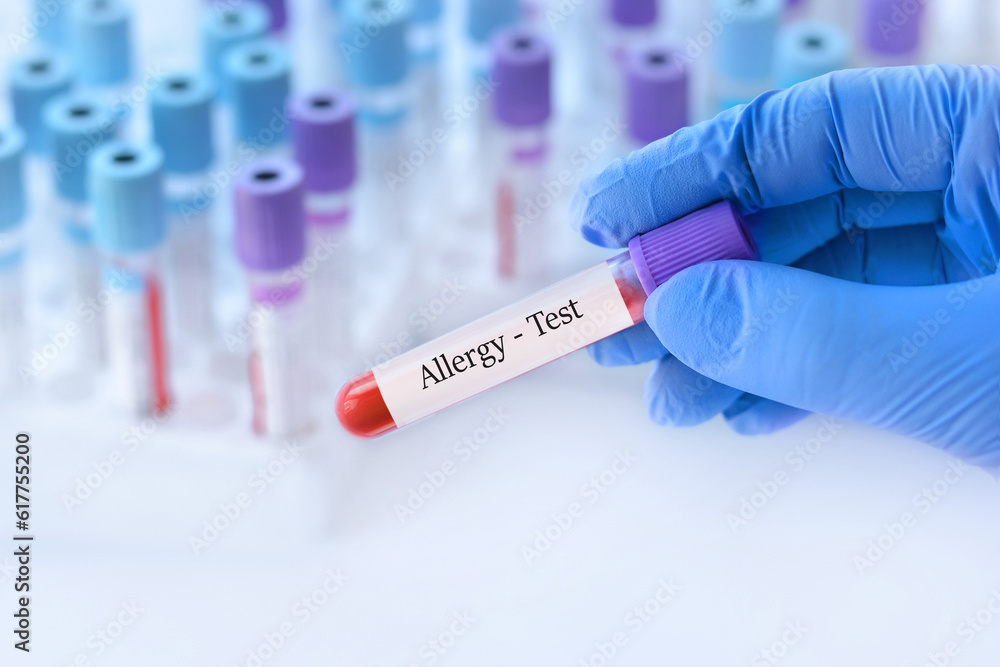 Doctor holding a test blood sample tube with allergy test on the background of medical test tubes with analyzes