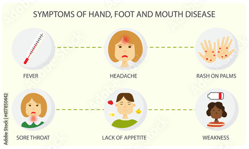 Hand, foot, and mouth disease (HFMD) symptoms fever headache sore throat rash on palms lack of appetite weakness illustration poster photo