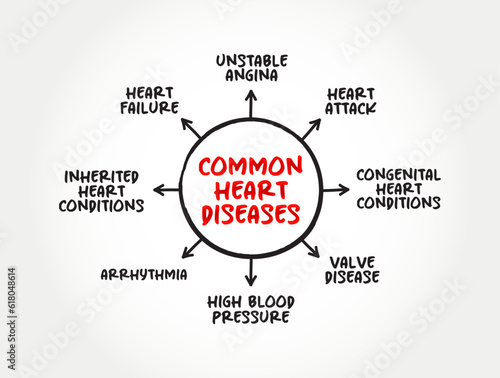 Common heart diseases mind map text concept for presentations and reports
