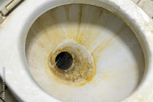 Close up shot of a dirty toilet bowl.