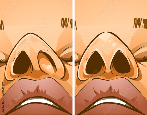 Rhinoplasty, before and after. Correction the shape of the human's nose. Medical illustration. Vector illustration.